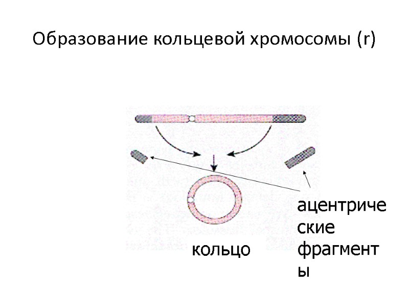 Образование кольцевой хромосомы (r) кольцо ацентрические фрагменты